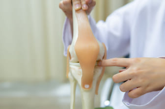 Prótesis de revisión de rodilla o Artroplastia de revisión de rodilla